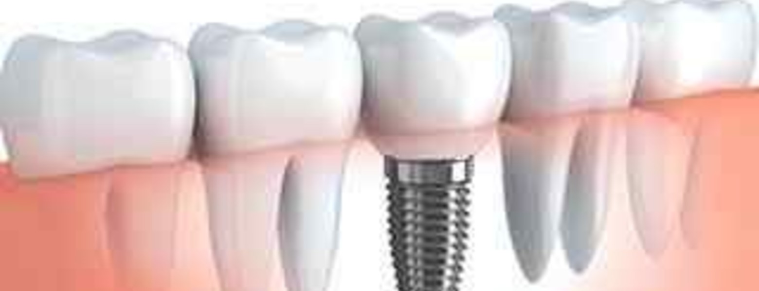 Foto de Clínica Dental Florida en L'Hospitalet de Llobregat - Imagen 1