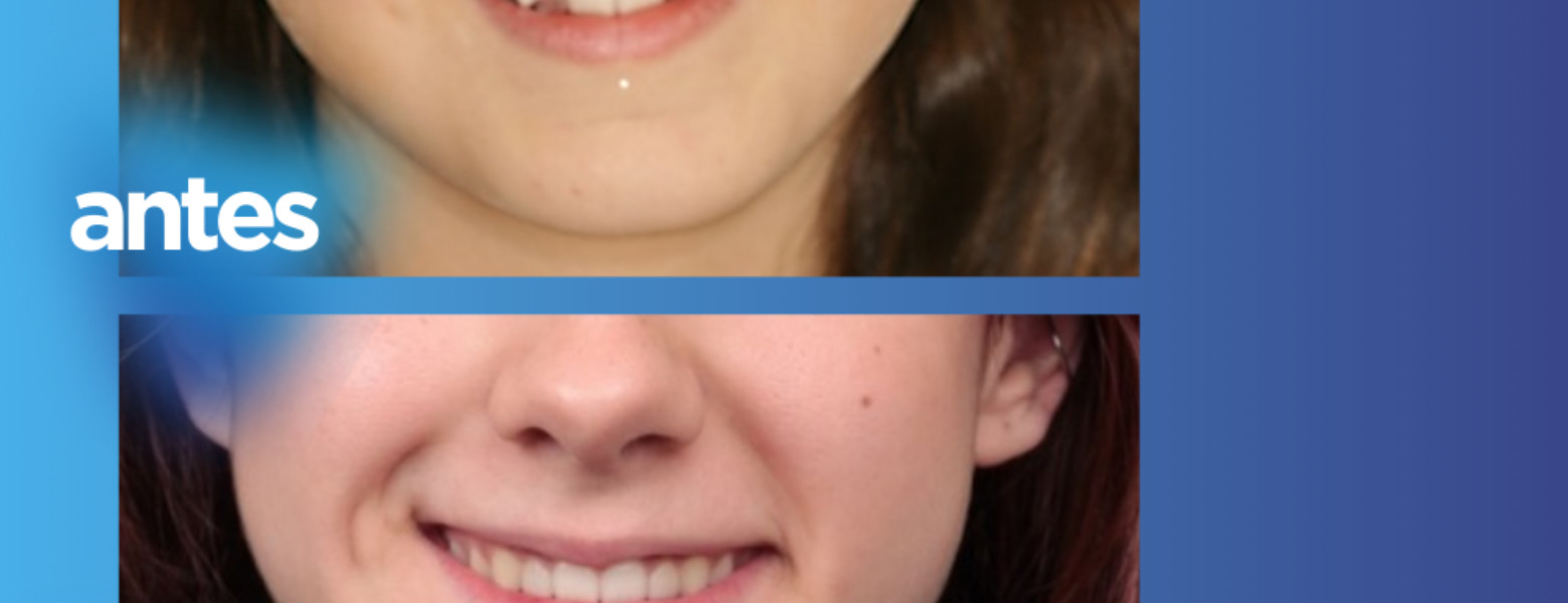 Foto de Clínica Dental Casher - Dentista Alicante en Alicante (Alacant) - Imagen 4