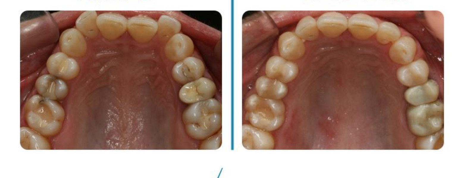 Foto de Clínica Dental Casher - Dentista Alicante en Alicante (Alacant) - Imagen 3