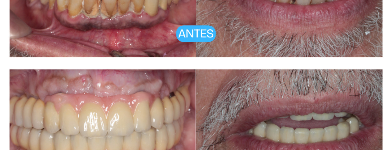 Foto de Clínica Dental Casher - Dentista Alicante en Alicante (Alacant) - Imagen 5