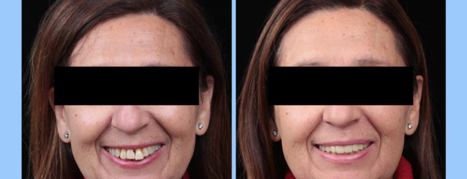 Foto de Clínica Dental Casher - Dentista Alicante en Alicante (Alacant) - Imagen 2