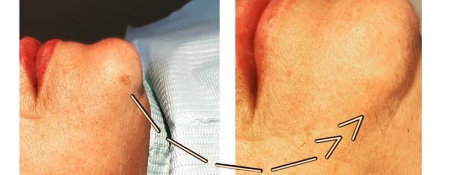 Foto de PESTAÑA DONNA ESTÉTICA | Extensiones de pestañas en Sevilla | Micropigmentación en Sevilla - Imagen 4
