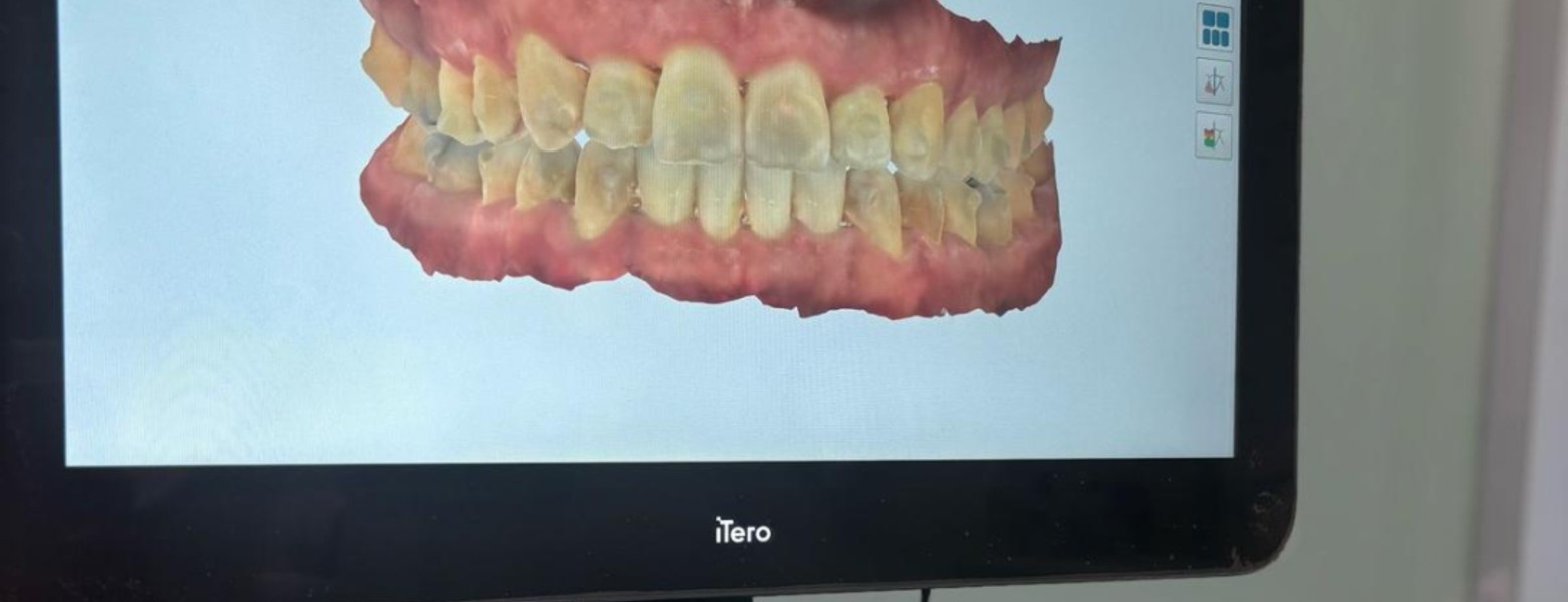 Foto de Acedo Dental Seseña en Seseña - Imagen 3