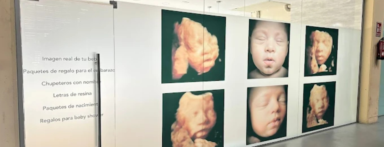 Foto de Deleite ecografías 5D en Mollet del Vallès - Imagen 2