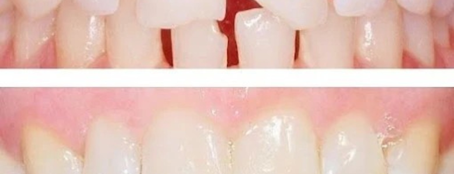 Foto de Clínica Dental Ortodoncia Rivero en Madrid - Imagen 3