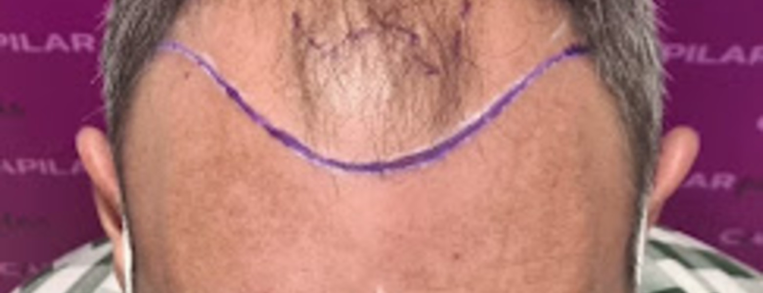 Foto de Capilar Plus en Dos Hermanas - Imagen 2